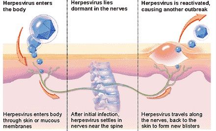 How Herpes Is Transmitted