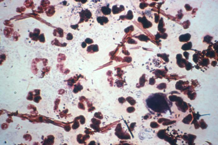 Neisseria Gonorrhoeae Gram Stain