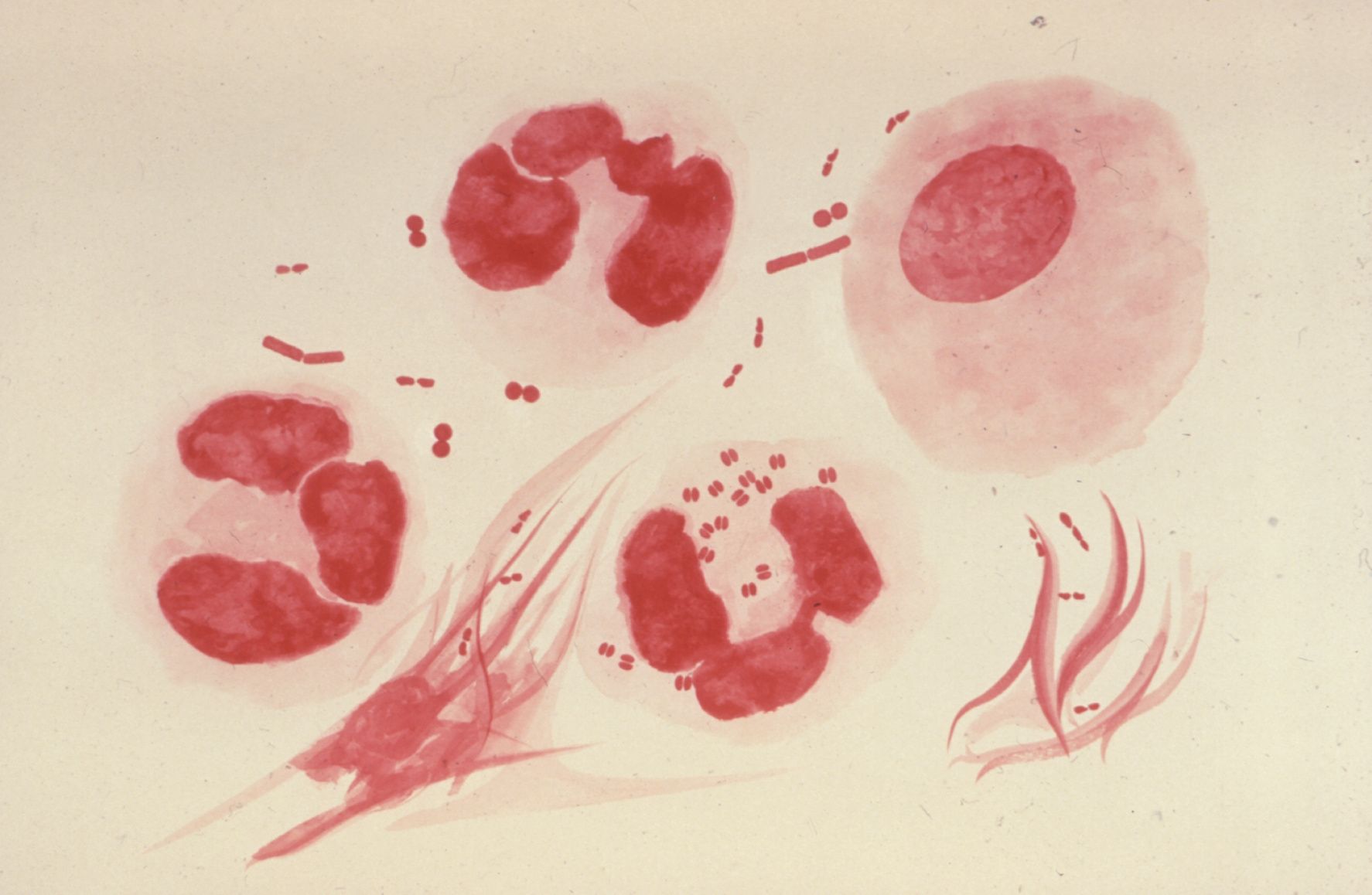 Neisseria gonorrhoeae 2