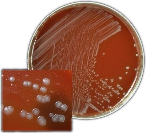 Neisseria gonorrhoeae bacteria test