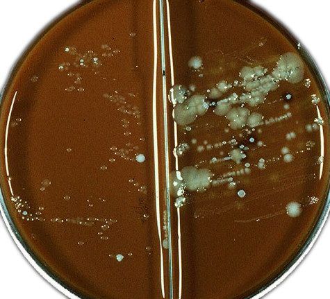 microbiologic diagnosis of gonorrhea