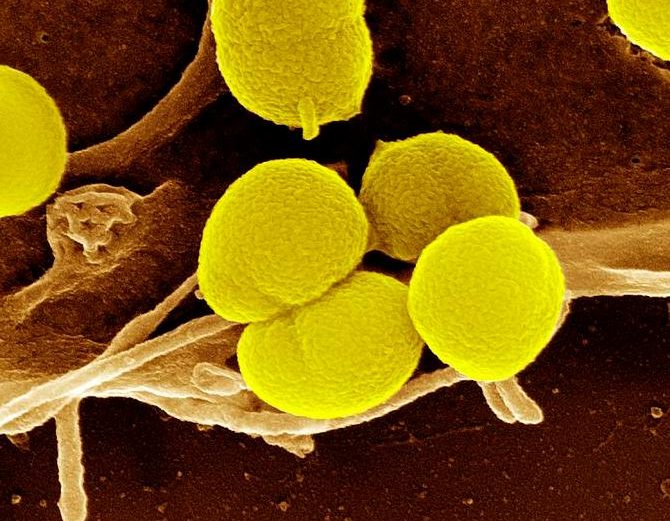 Coloured scanning electron micrograph (SEM) of Neisseria gonorrhoeae bacteria (round, yellow) on the surface of an epithelial cell (brown).