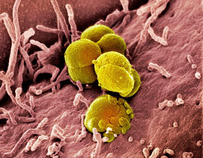 Coloured scanning electron micrograph (SEM) of a Neisseria gonorrhoeae bacteria (yellow) infecting a human epithelial cell (brown).