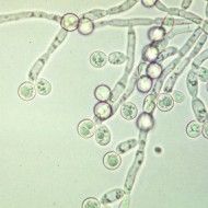 Candida Albicans under microscope