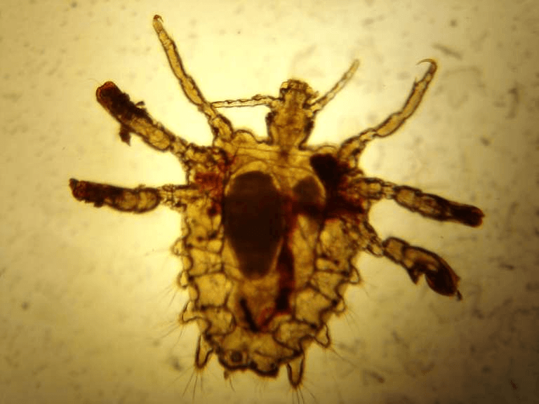 Female pubic louse (Crab louse) (Binomial name - Phthirus pubis)