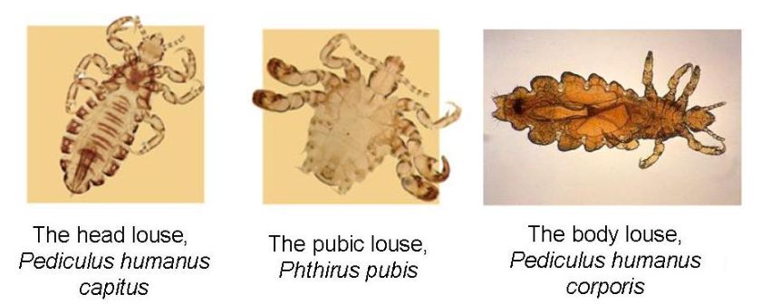 Head, Pubic and Body Louse