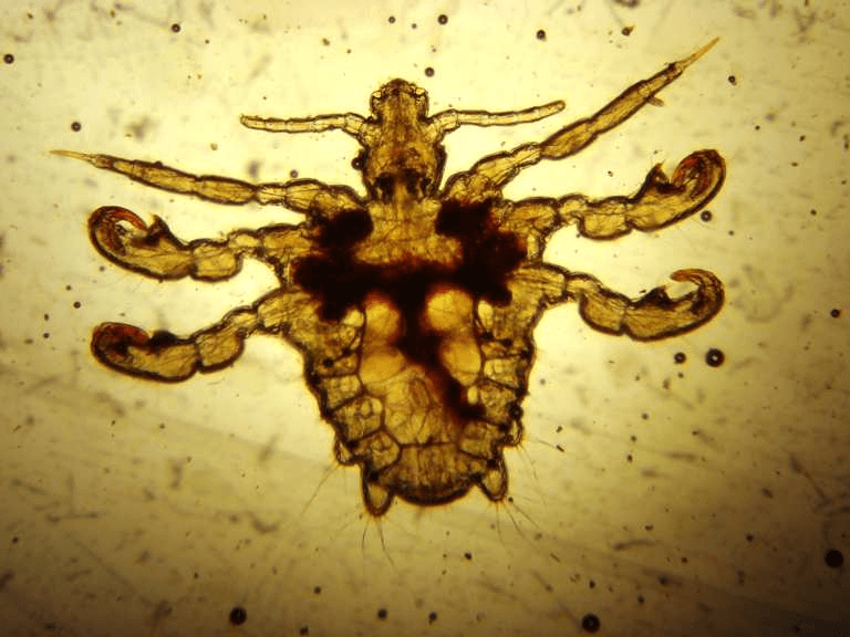 Male pubic louse (Crab louse) (Binomial name - Phthirus pubis)