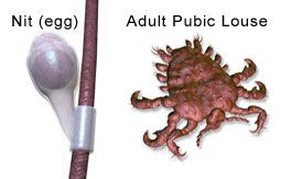 Nit (egg) and Adult Pubic Louse