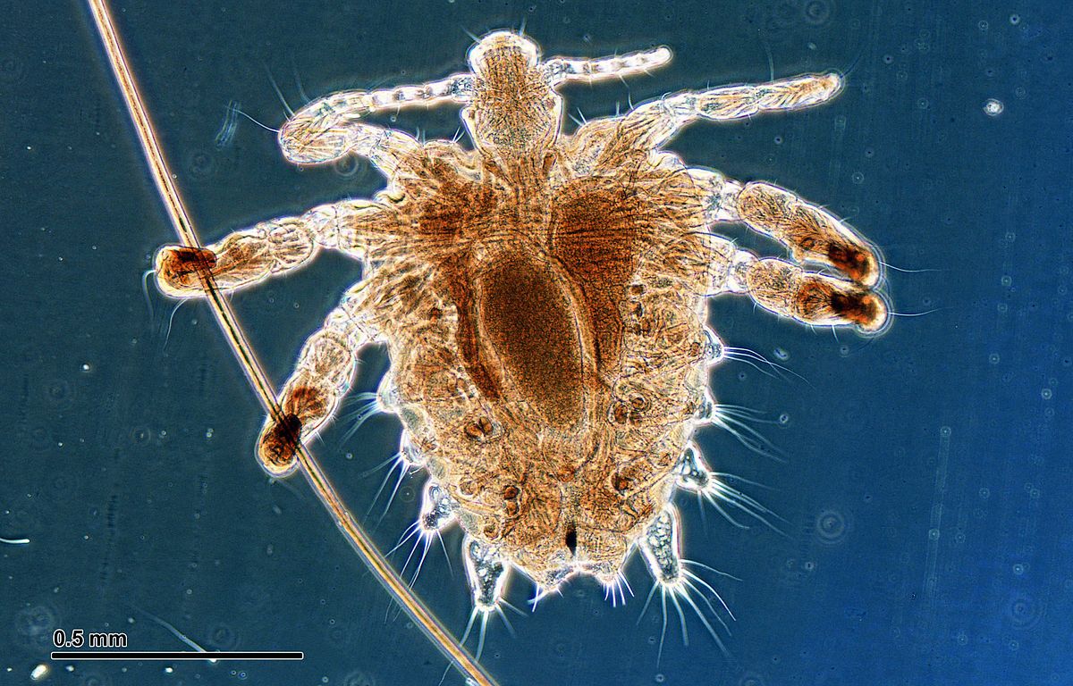 Pthirus pubis