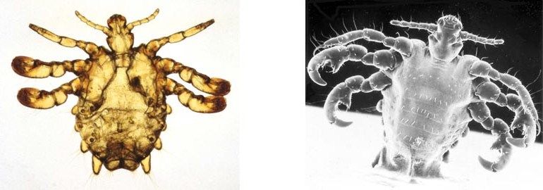 Pubic Lice – Crabs STD