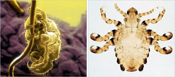Pubic Lice