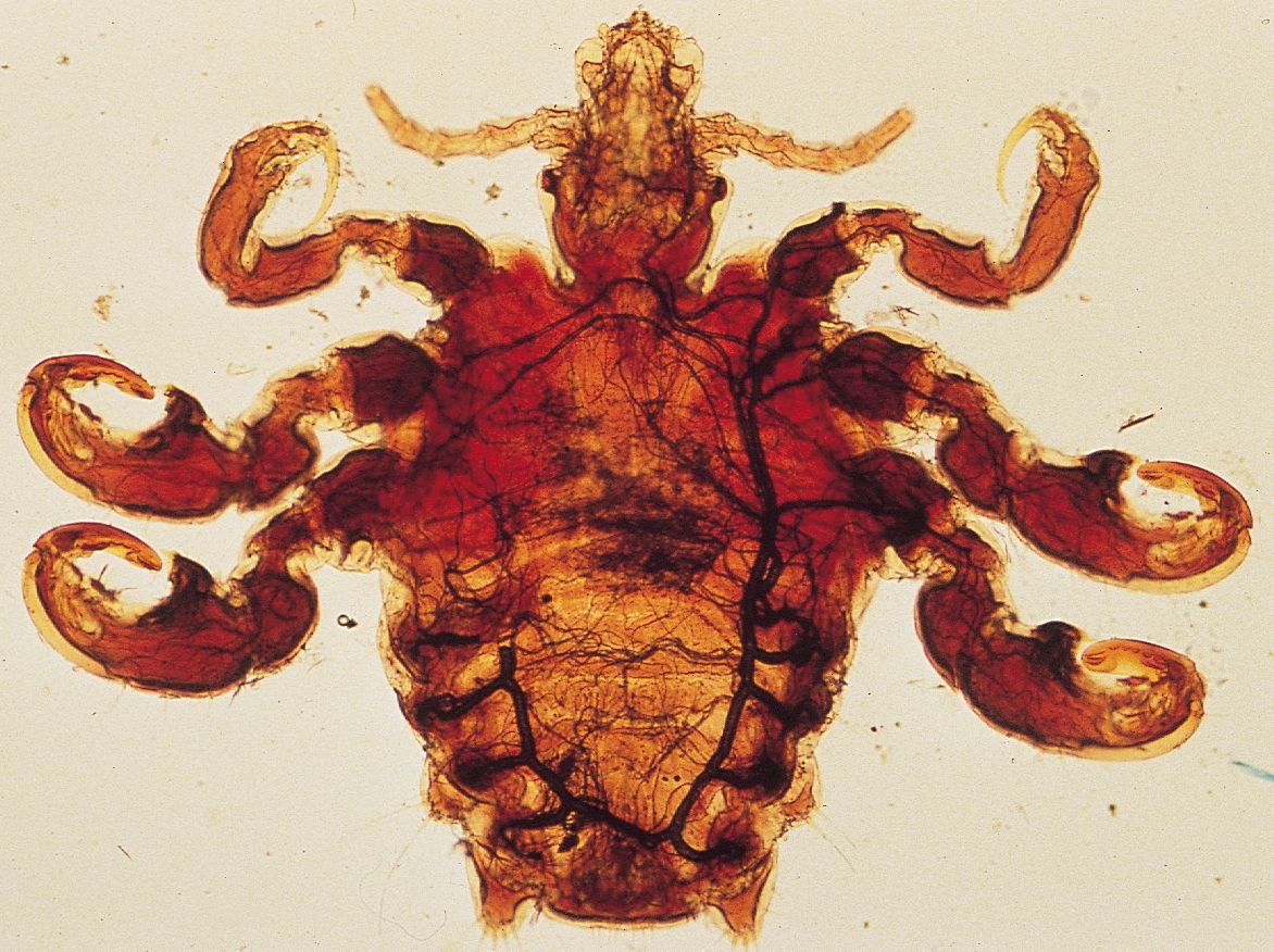 Pubic Louse