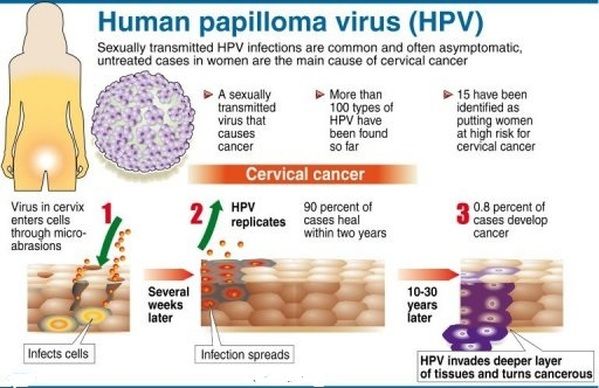 Human papilloma virus (HPV) and cancer