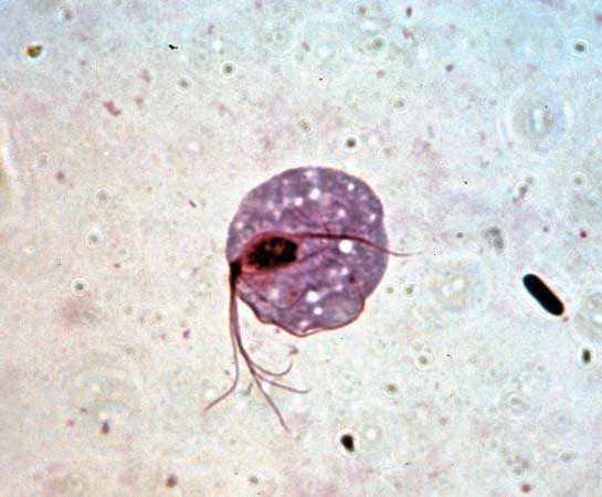 Trichomonas vaginalis