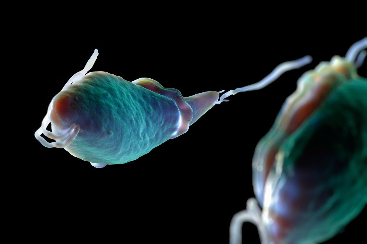 Trichomoniasis infection picture
