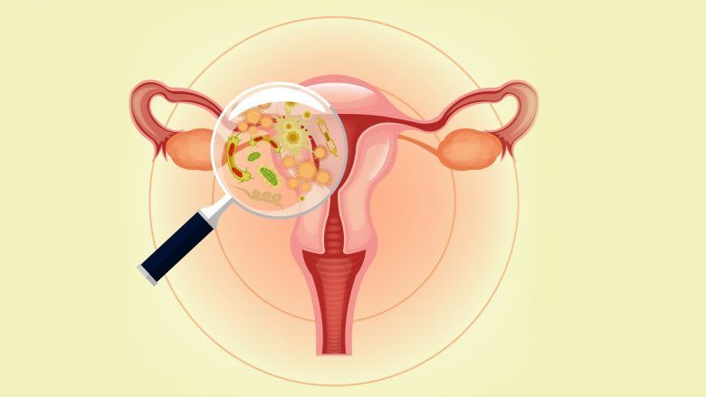 Diagnosis of bacterial vaginosis