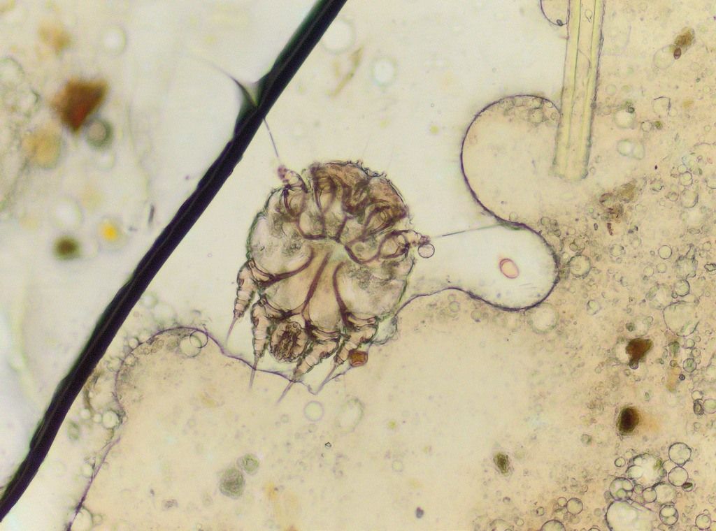 Light microscopy image of a Sarcoptes scabiei