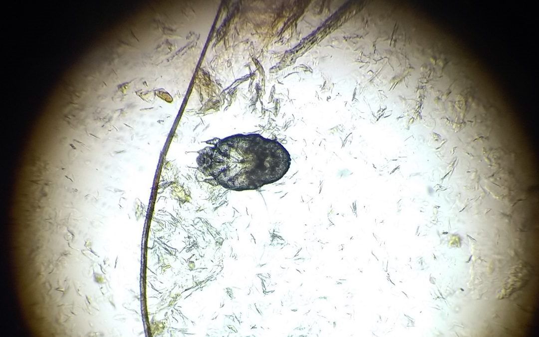 Sarcoptes scabiei (Scabies) in light microscope