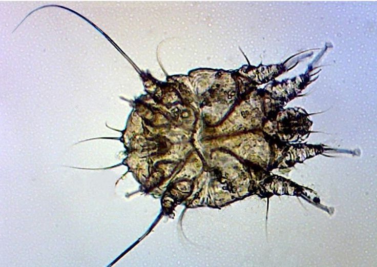 Sarcoptes scabiei