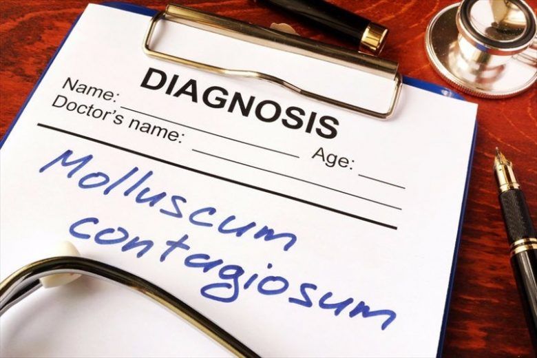 Diagnosis of molluscum contagiosum