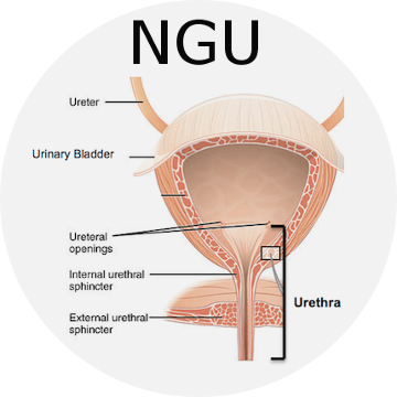 Non-Gonococcal Urethritis